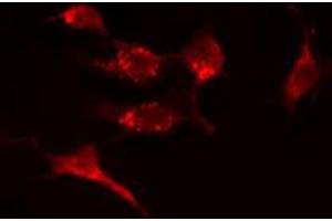 ABIN6274389 staining A549 cells by IF/ICC. (CERKL anticorps  (Internal Region))
