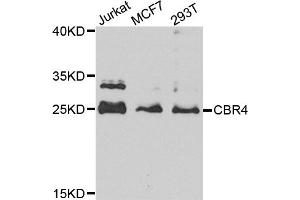 Western blot analysis of extracts of various cell lines, using CBR4 antibody (ABIN5972931) at 1/1000 dilution. (CBR4 anticorps)