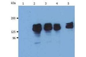 Western Blotting (WB) image for anti-Inositol Polyphosphate-5-Phosphatase, 145kDa (INPP5D) (N-Term) antibody (ABIN238500) (INPP5D anticorps  (N-Term))