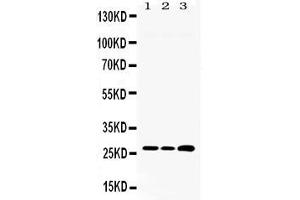 Western blot analysis of RPL19 expression in rat liver extract ( Lane 1) HEPA whole cell lysates ( Lane 2) and HEPG2 whole cell lysates ( Lane 3). (RPL19 anticorps  (C-Term))