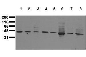 Western Blotting (WB) image for anti-Mitogen-Activated Protein Kinase Kinase 3 (MAP2K3) antibody (ABIN126840) (MAP2K3 anticorps)