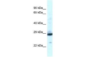 Western Blot showing PGAM1 antibody used at a concentration of 1 ug/ml against Fetal Liver Lysate (PGAM1 anticorps  (C-Term))