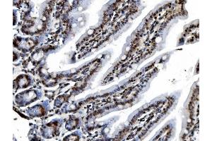 IHC analysis of REA/PHB2 using anti-REA/PHB2 antibody (ABIN7599239). (Prohibitin 2 anticorps  (AA 1-299))