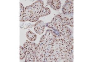 Immunohistochemical analysis of A on paraffin-embedded Human placenta tissue. (TARDBP anticorps  (N-Term))