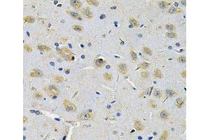 Immunohistochemistry of paraffin-embedded Rat brain using RRAGC Polyclonal Antibody at dilution of 1:100 (40x lens).