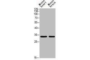 Western blot analysis of MOUSE-HEART MOUSE-BRAIN using Acetyl-TAL1/2 (K221/K222/K36/K37) antibody. (TAL1 anticorps  (acLys36, acLys37, acLys221, acLys222))