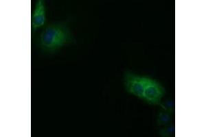 Anti-SDR9C7 mouse monoclonal antibody (ABIN2453629) immunofluorescent staining of COS7 cells transiently transfected by pCMV6-ENTRY SDR9C7 (RC210941). (SDR9C7 anticorps)