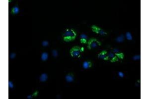 Image no. 3 for anti-Golgin, RAB6-Interacting (GORAB) (AA 35-394) antibody (ABIN1491439)