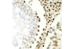 Immunohistochemistry of paraffin-embedded rat testis using NFKB2 antibody at dilution of 1:200 (400x lens). (NFKB2 anticorps)