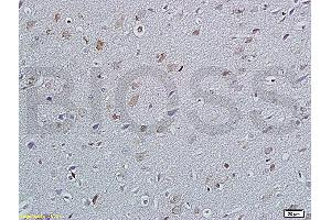 Formalin-fixed and paraffin embedded rat brain labeled with Anti P45017A1/Cytochrome P450 17A1 Polyclonal Antibody, Unconjugated (ABIN720445) at 1:200 followed by conjugation to the secondary antibody and DAB staining (GANAB anticorps  (AA 428-540))