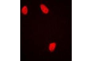 Immunofluorescent analysis of NUDC staining in HepG2 cells. (NUDC anticorps)