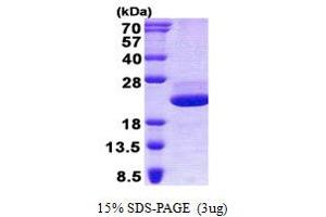Image no. 1 for Galectin-Related Protein (GRP) (AA 1-172) protein (His tag) (ABIN1098554)