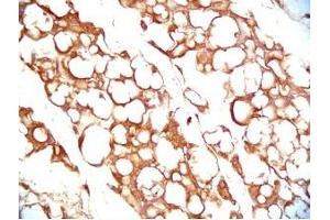 Mouse visceral white fat tissue was stained by Rabbit Anti-Vaspin (386-414) (Human) Serum