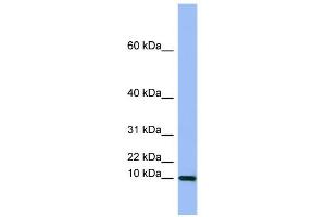 WB Suggested Anti-SEMG1  Antibody Titration: 0. (SEMG1 anticorps  (Middle Region))