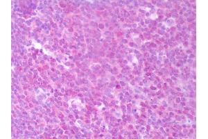 Anti-IIL-22 antibody IHC of human tonsil. (IL-22 anticorps)