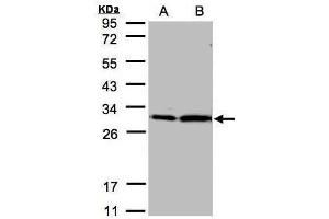 WB Image Sample(30 μg of whole cell lysate) A:Hep G2, B:MOLT4, 12% SDS PAGE antibody diluted at 1:2000 (14-3-3 zeta anticorps  (Center))