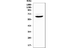 Western blot analysis of Heparanase 1 using anti-Heparanase 1 antibody (ABIN5518844).