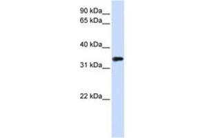 Image no. 1 for anti-Methyl-CpG Binding Domain Protein 3 (MBD3) (AA 72-121) antibody (ABIN6740655) (MBD3 anticorps  (AA 72-121))