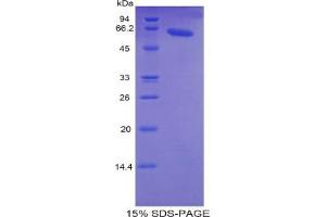 SDS-PAGE analysis of Human TNNC2 Protein. (TNNC2 Protéine)