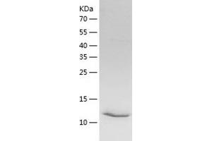 Succinate Dehydrogenase Complex Assembly Factor 2 (Sdhaf2) (AA 30-166) protein (His-IF2DI Tag)