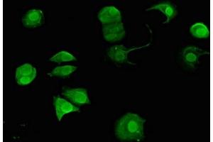 Immunofluorescent analysis of MCF-7 cells using ABIN7144143 at dilution of 1:100 and Alexa Fluor 488-congugated AffiniPure Goat Anti-Rabbit IgG(H+L)