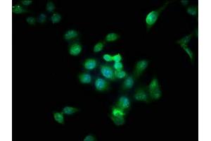 Immunofluorescence staining of Hela cells with ABIN7145079 at 1:166, counter-stained with DAPI. (Aurora Kinase B anticorps  (AA 1-255))