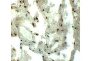 Immunohistochemical staining of human lung cells with GCOM1 polyclonal antibody  at 5 ug/mL.
