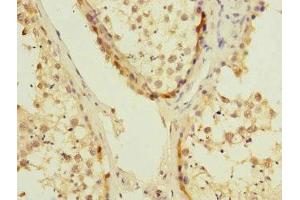 Immunohistochemistry of paraffin-embedded human testis tissue using ABIN7174484 at dilution of 1:100