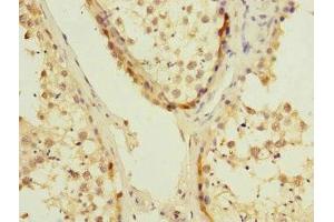 Immunohistochemistry of paraffin-embedded human testis tissue using ABIN7174484 at dilution of 1:100 (UBE2S anticorps  (AA 1-222))