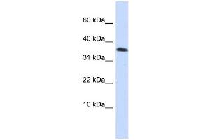 WB Suggested Anti-EMX1 Antibody Titration:  0.