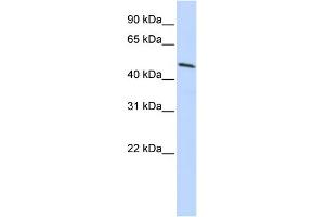WB Suggested Anti-HOXB3 Antibody Titration: 0. (HOXB3 anticorps  (N-Term))