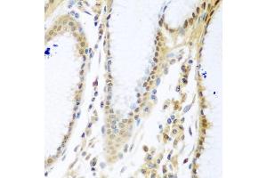 Immunohistochemistry of paraffin-embedded human stomach using MYBBP1A antibody (ABIN5972490) at dilution of 1/100 (40x lens). (MYBBP1A anticorps)