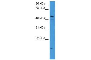 WB Suggested Anti-ZNF713 Antibody Titration: 0. (ZNF713 anticorps  (N-Term))
