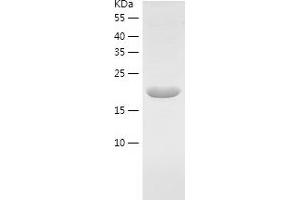 Chromosome 6 Open Reading Frame 108 (C6orf108) (AA 1-174) protein (His-IF2DI Tag)
