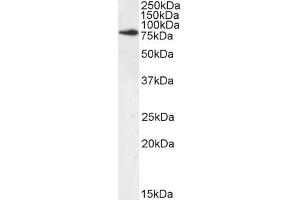 ABIN184679 (1µg/ml) staining of Mouse Brain lysate (35µg protein in RIPA buffer). (NUMB anticorps  (C-Term))