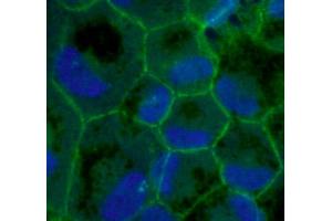 Immunofluorescence of primary RPE cells with ZO1 Ab at 1/100 dilution,