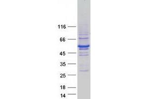 Validation with Western Blot (RNF14 Protein (Transcript Variant 3) (Myc-DYKDDDDK Tag))