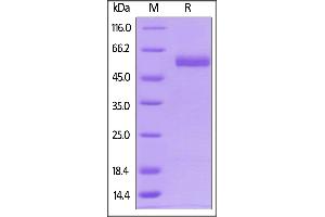 Biotinylated Human CD4, His,Avitag on  under reducing (R) condition.