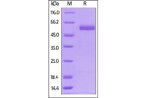 Biotinylated Human CD4, His,Avitag on  under reducing (R) condition. (CD4 Protein (CD4) (AA 26-396) (His tag,AVI tag,Biotin))