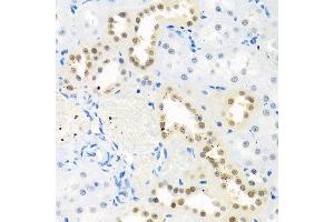 anti-THO Complex 1 (THOC1) (AA 428-657) antibody