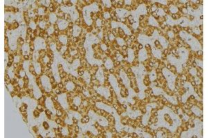 ABIN6269289 at 1/100 staining Mouse liver tissue by IHC-P.