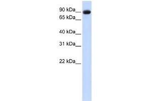 POSTN antibody used at 1 ug/ml to detect target protein. (Periostin anticorps  (Middle Region))