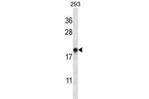 TMM85 Antibody (N-term) western blot analysis in 293 cell line lysates (35 µg/lane). (EMC4 anticorps  (N-Term))