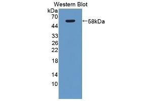 Western Blotting (WB) image for anti-Myosin IC (MYO1C) (AA 765-1011) antibody (ABIN1078388)