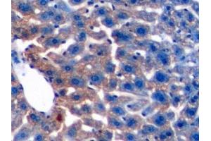 Detection of TGFb1 in Mouse Liver Tissue using Polyclonal Antibody to Transforming Growth Factor Beta 1 (TGFb1)