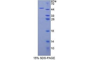 SDS-PAGE (SDS) image for Membrane Metallo-Endopeptidase (MME) (AA 286-428) protein (GST tag) (ABIN1877291)