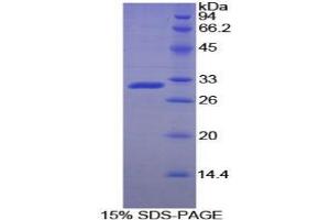 SDS-PAGE analysis of Rat ACP5 Protein.