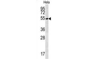 Western Blotting (WB) image for anti-tRNA Methyltransferase 11 Homolog (Trmt11) antibody (ABIN3002328) (Trmt11 anticorps)