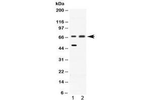 Western blot testing of 1) rat liver and 2) HeLa lysate with ACADVL antibody at 0. (ACADVL anticorps  (AA 538-576))