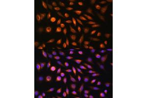 Immunofluorescence analysis of L929 cells using SH3PXD2A Rabbit pAb (ABIN6135104, ABIN6147731 and ABIN7101844) at dilution of 1:100. (SH3PXD2A anticorps)